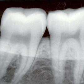 Дентальная визиография